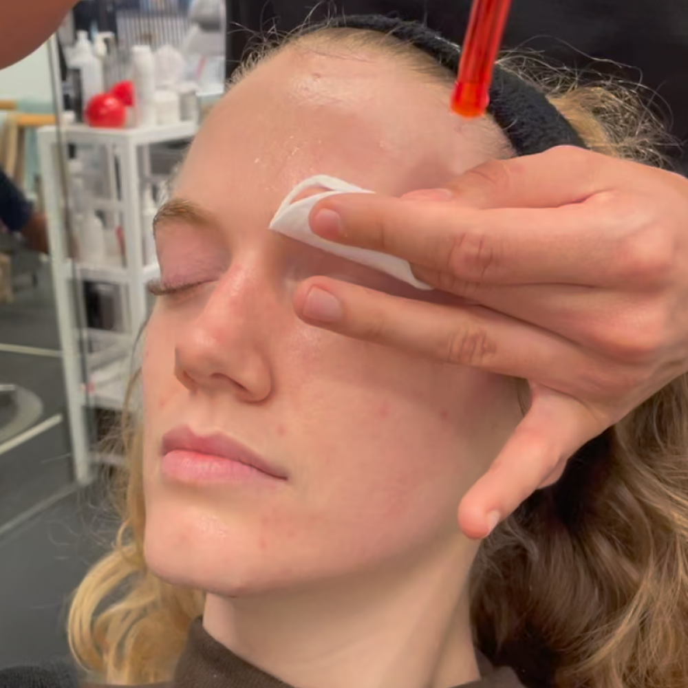 Clear Skin Naturally