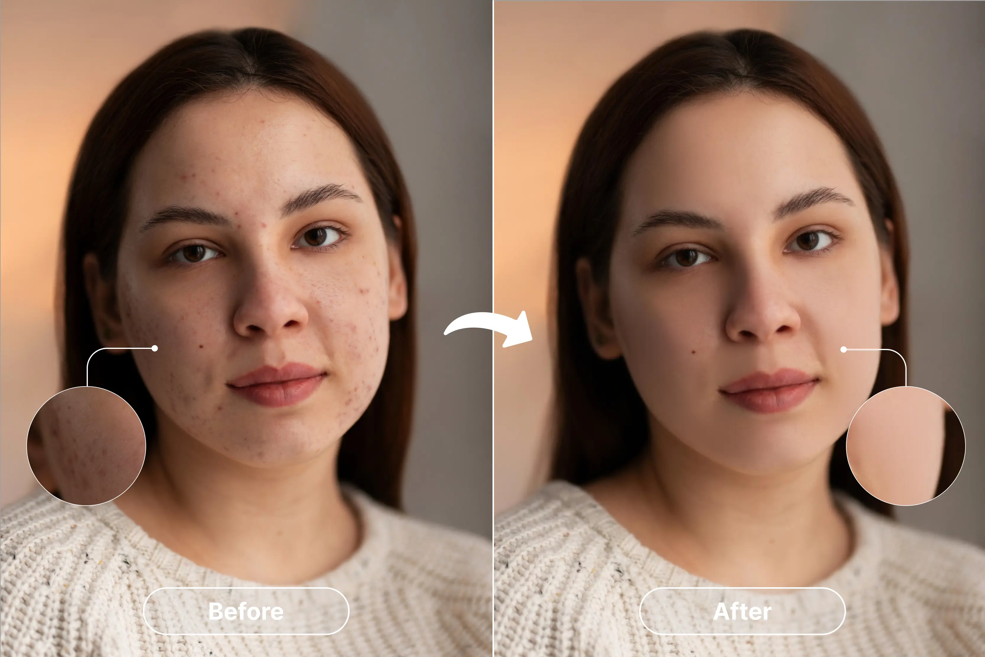 How to use a blemish remover tool to make photos clean