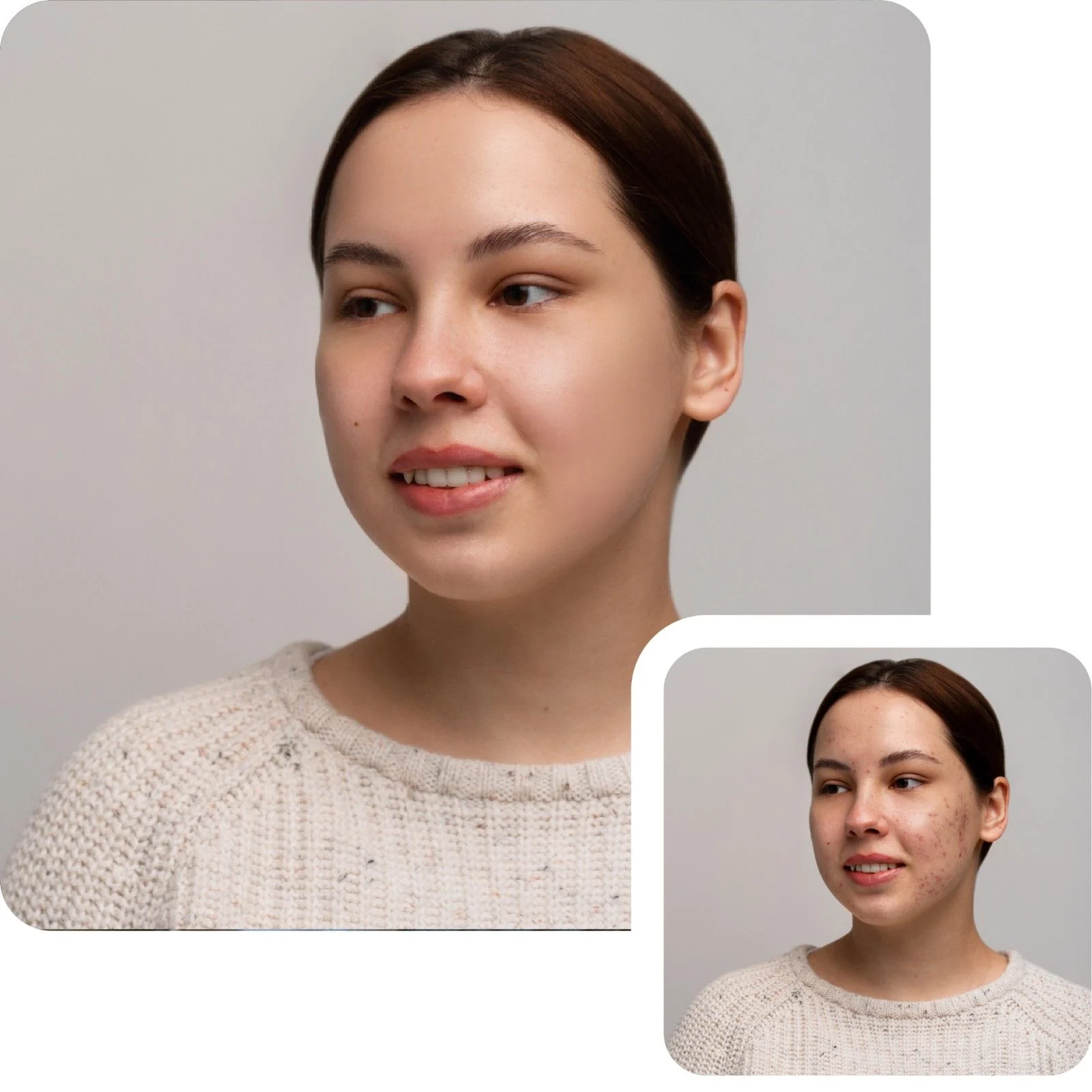 No editing skills needed