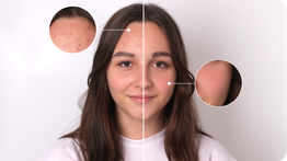 Blemish remover