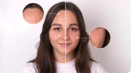 AI blemish remover