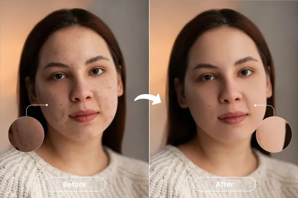 How to use a blemish remover tool to perfect your photos?