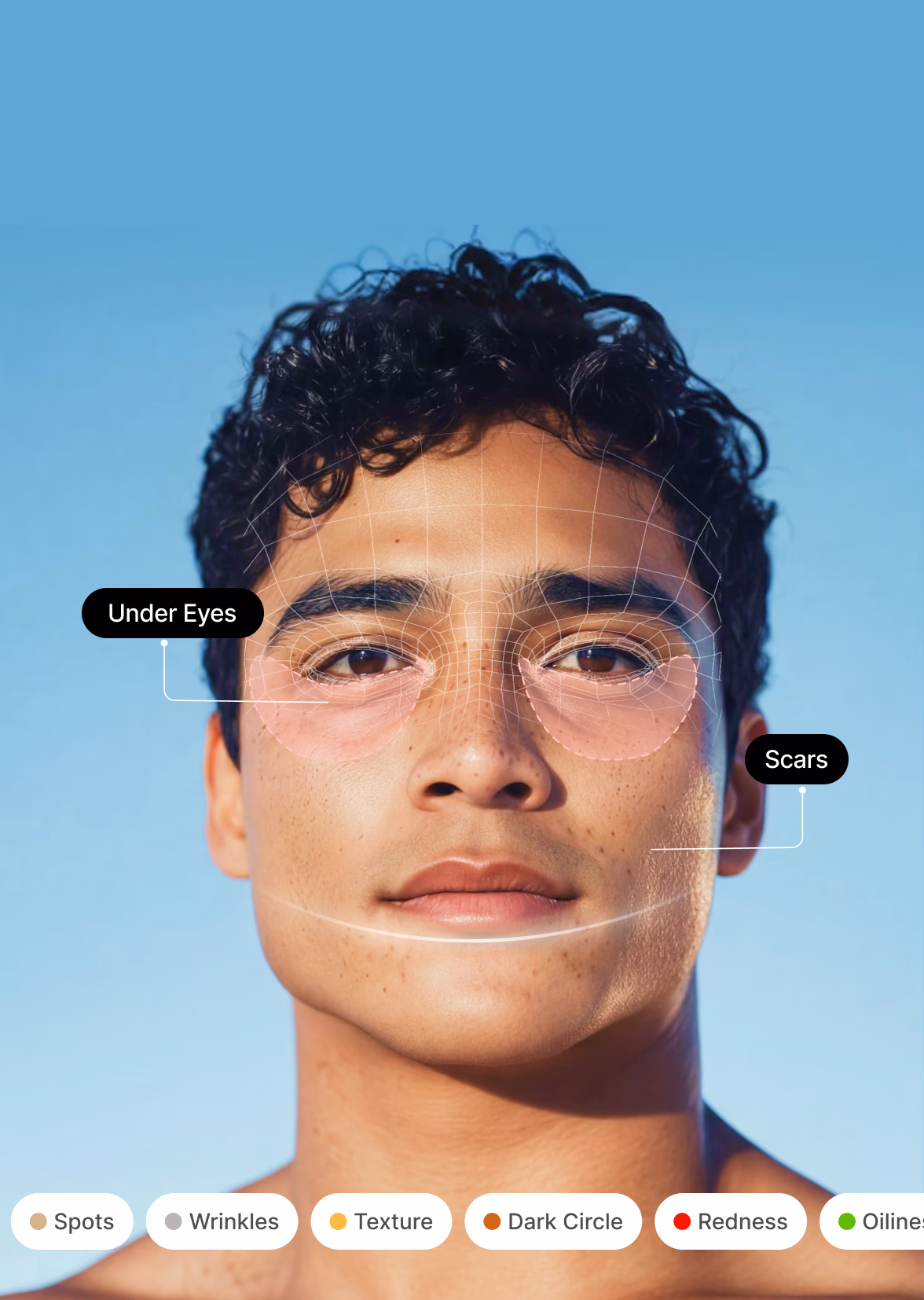 Clinical skin scan with annotated zones and issue labels