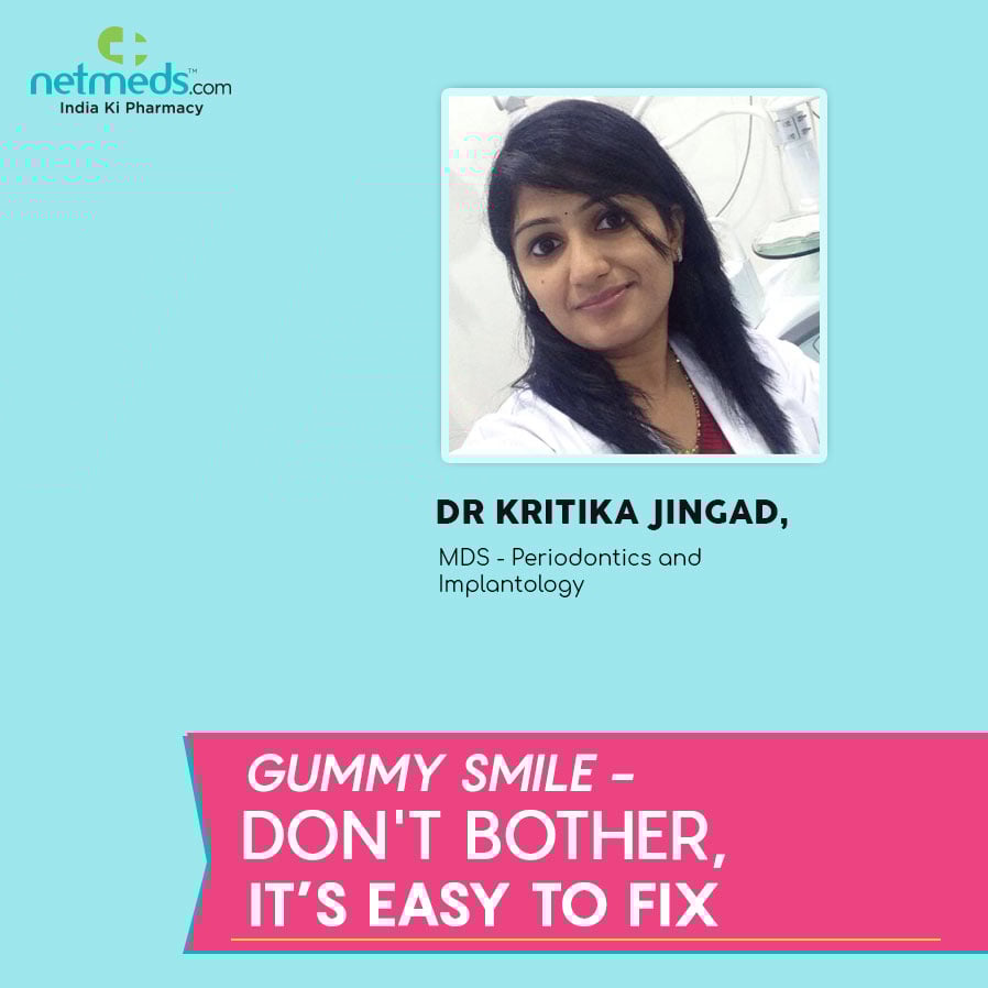 Gummy Smile - Don't Bother, It’s Easy To Fix By Dr Kritika Jingad