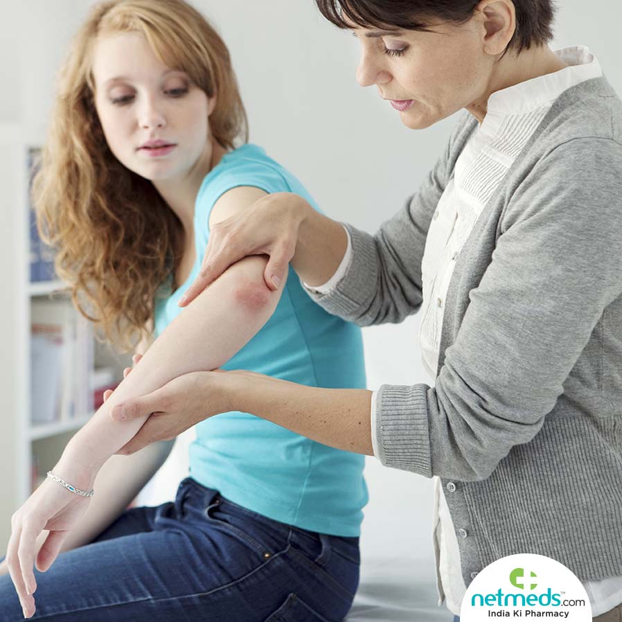Painful Psoriasis Can Show Up As Bleeding Cracks
