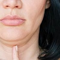 Double Chin: How To Get Rid Of It Naturally