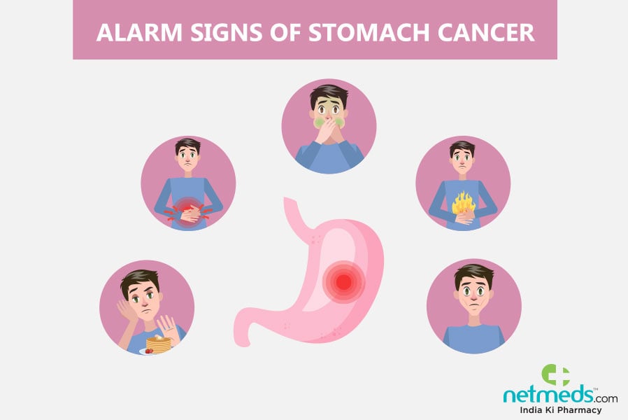 Gastric cancer