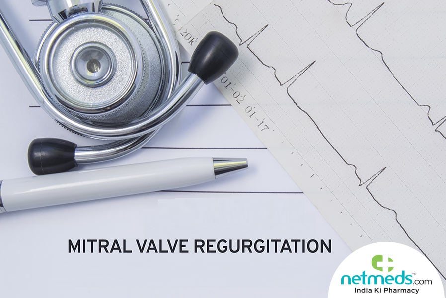 mitral valve regurgitation
