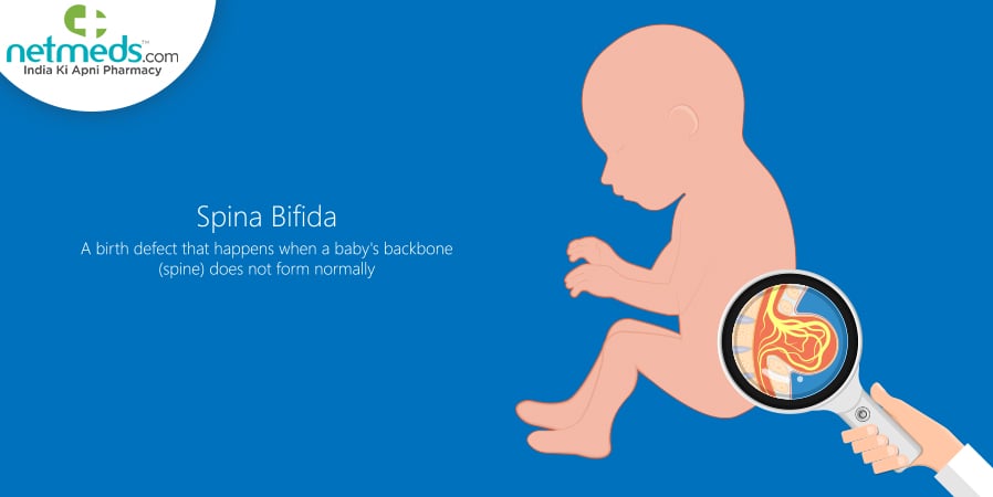 Spina Bifida