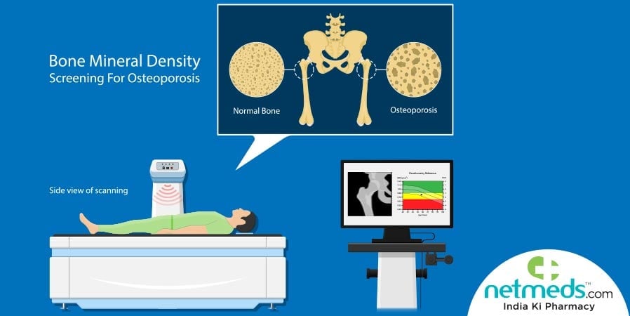 Bone Density Test Procedure