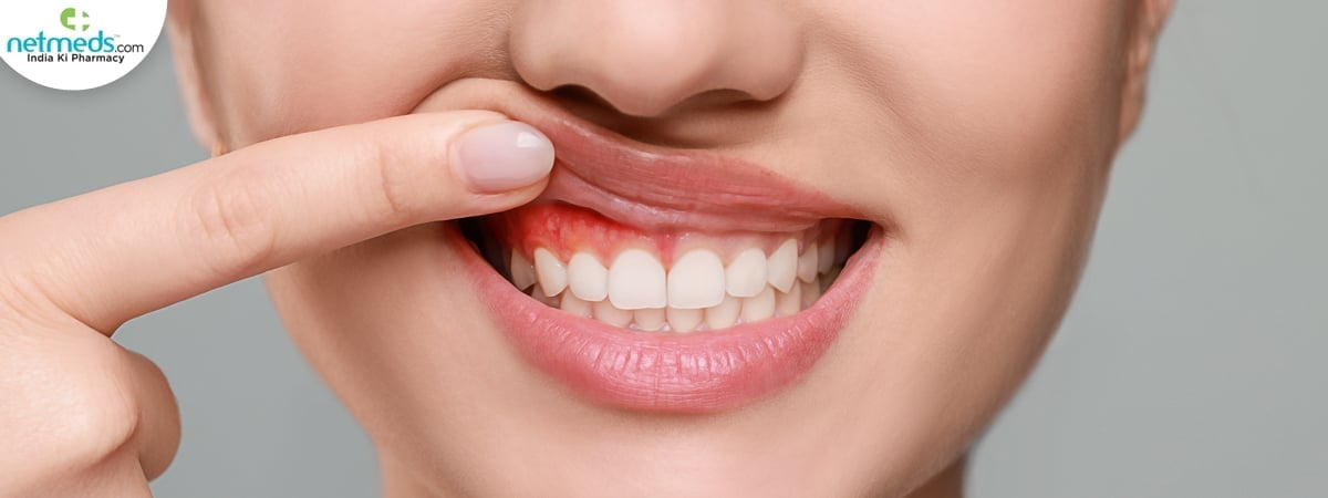 Gum disease
