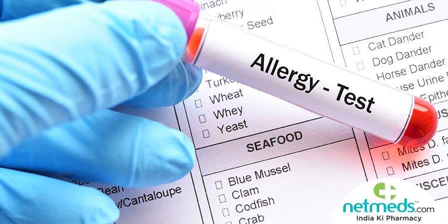 Allergy - Test