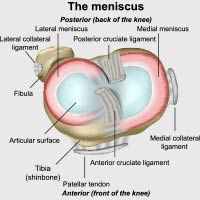 Torn Meniscus: Causes, Symptoms And Treatment