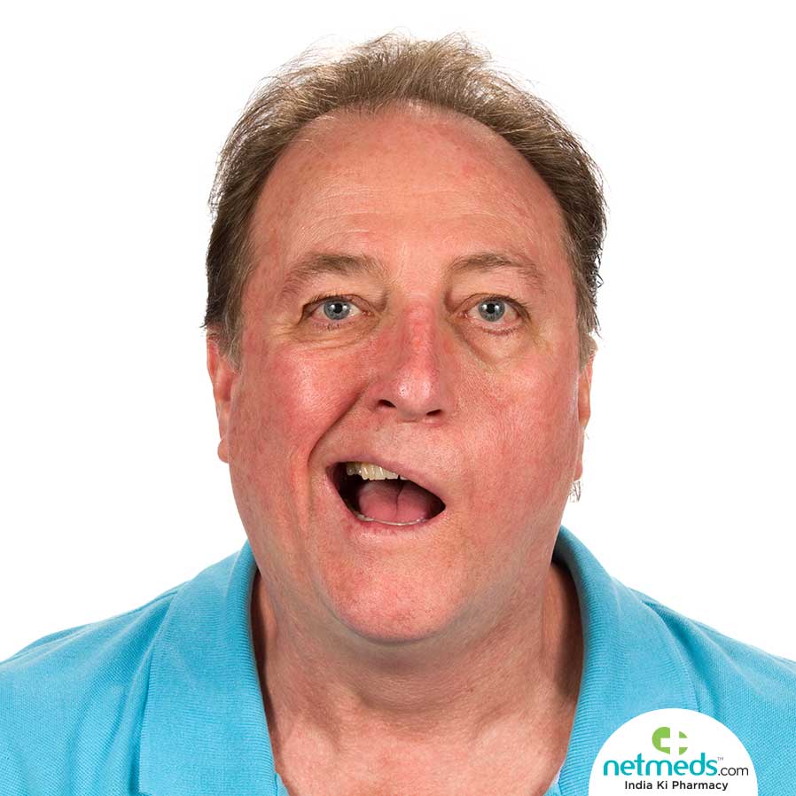 Man with Bell's Palsy
