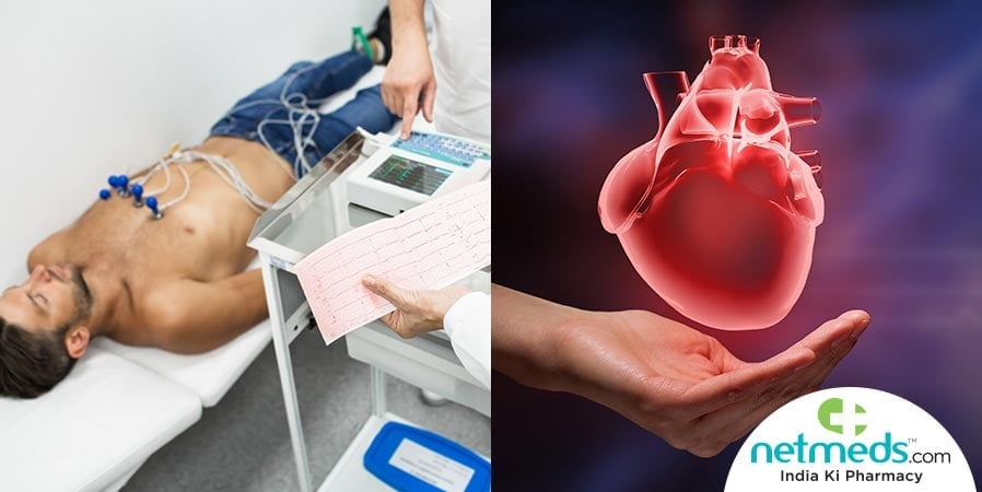 Man undergoing ECG