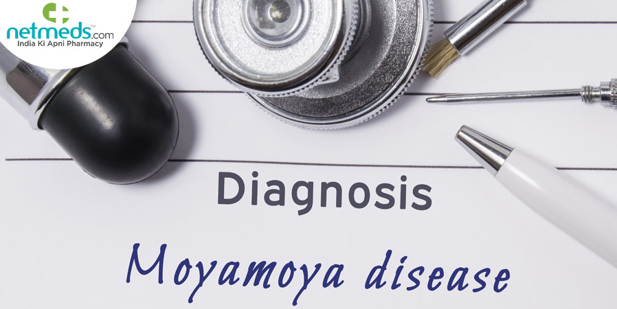 Diagnosis Moyamoya disease