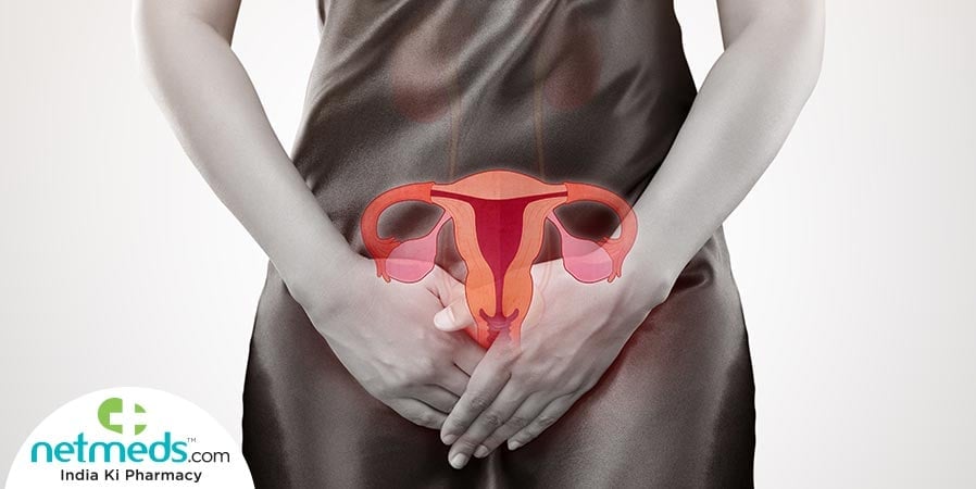 Woman with Bartholin's cysts