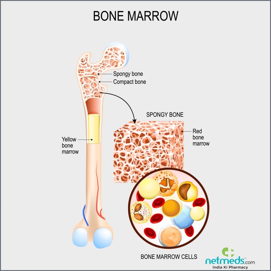 Bone cancer