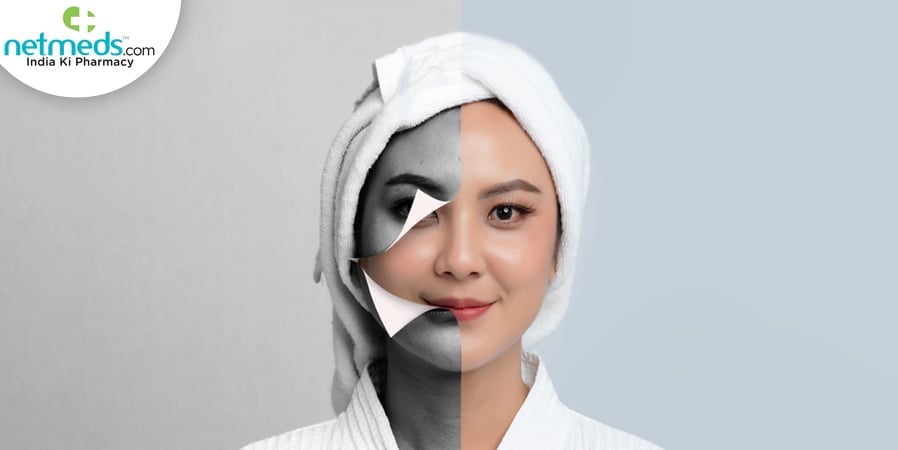 Hyperpigmentation