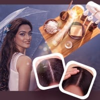 Dandruff During Monsoon? 5 Amazing Essential Oil-Infused Hair Masks To Get Rid Of Itchy Scalp - Infographic