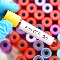 CCP Antibody Test: Procedure, Who Needs It? What Is It And What To Expect?