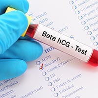 Pregnancy Test: What Is It And What To Expect?