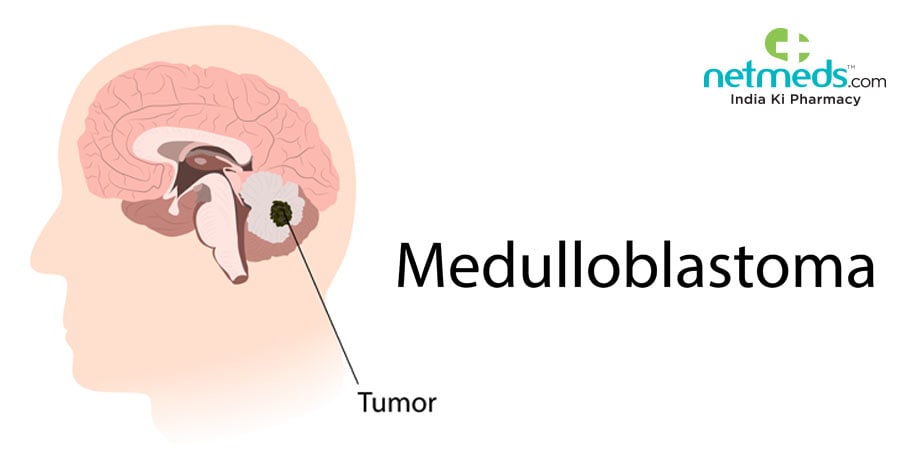 Medulloblastoma