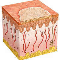 Merkel Cell Carcinoma: Causes, Symptoms And Treatment