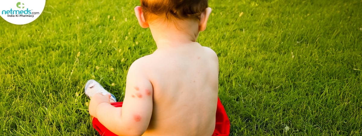 Bug-bite-remedies_1200x450