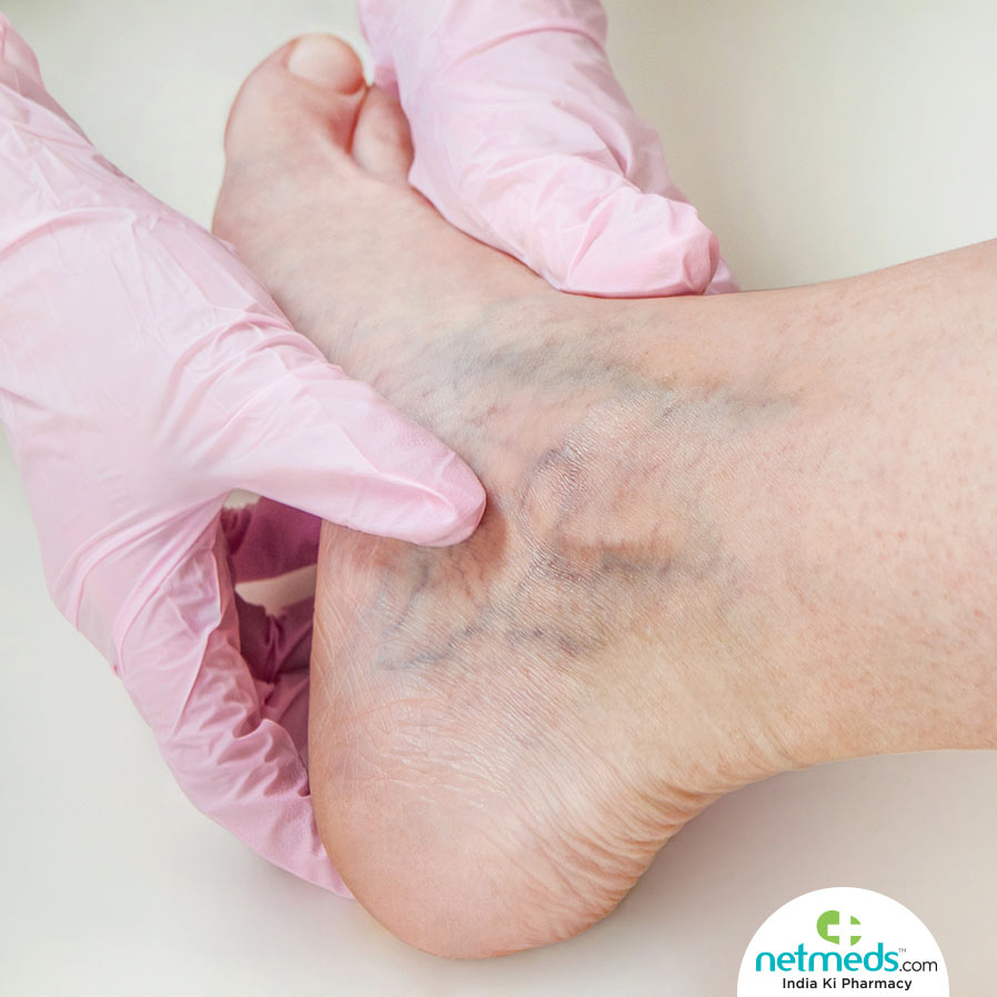 Checking For Vascular Disease