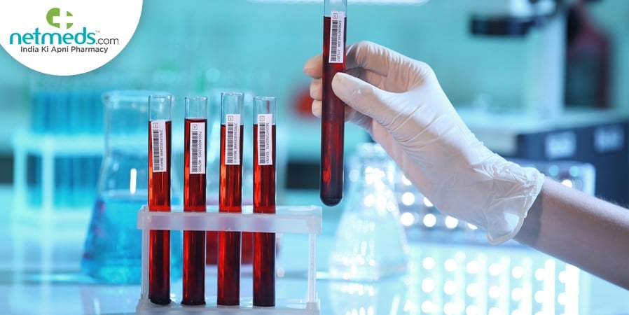 Diagnostic Tests