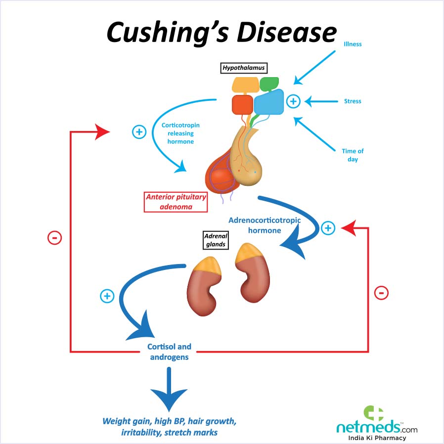 cushing syndrome