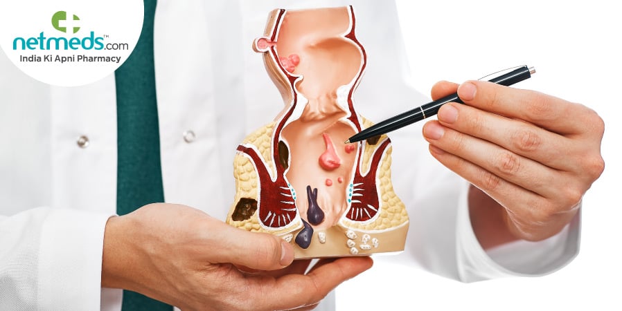 Rectovaginal Fistula