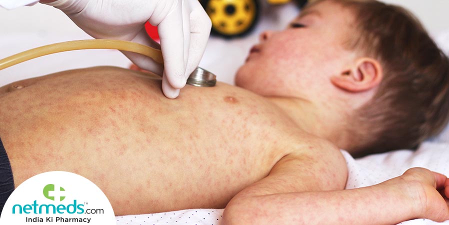 kid With Roseola