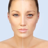 What Is Oxidative Stress? Causes, Symptoms And Prevention