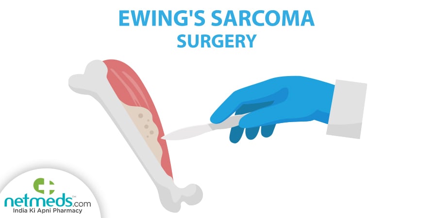 Ewings Sarcoma
