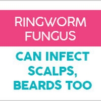 Ringworm Fungus Can Infect Scalps, Beards Too