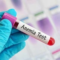 Sickle Cell Anemia: Causes and Symptoms