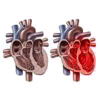 Broken Heart Syndrome/ Takotsubo Cardiomyopathy: Causes, Symptoms And Treatment