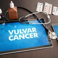 Vulvar Cancer: Causes, Symptoms And Treatment