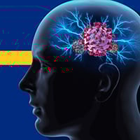 Coronavirus: 5 Neurological Symptoms Of COVID-19 That Affect Brain Health