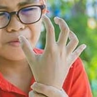 Juvenile Arthritis: Causes, Symptoms And Treatment
