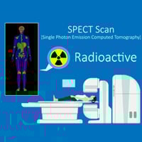 SPECT Scan: Procedure, Risks And Results
