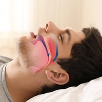 Ayurveda For Sleep Apnea: Natural Remedies To Cease Snoring And Ensure A Deep Slumber