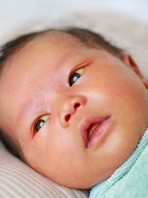 Newborn Jaundice: Causes, Symptoms And Treatment