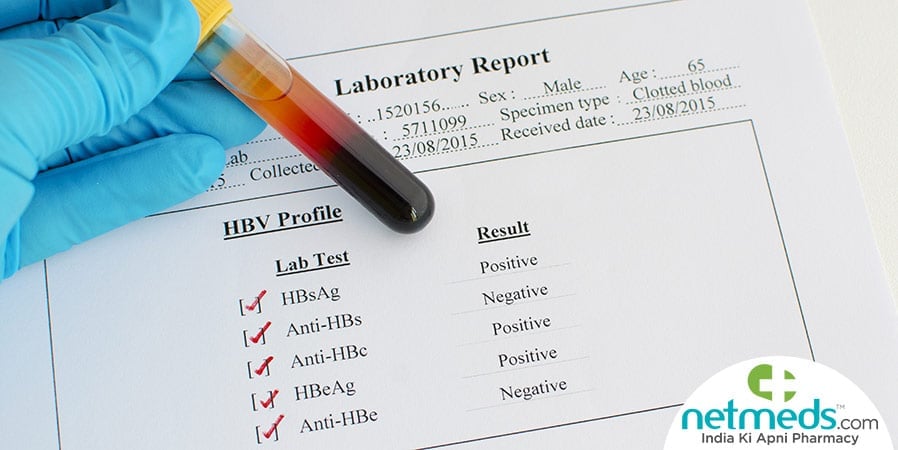 Fever profile test
