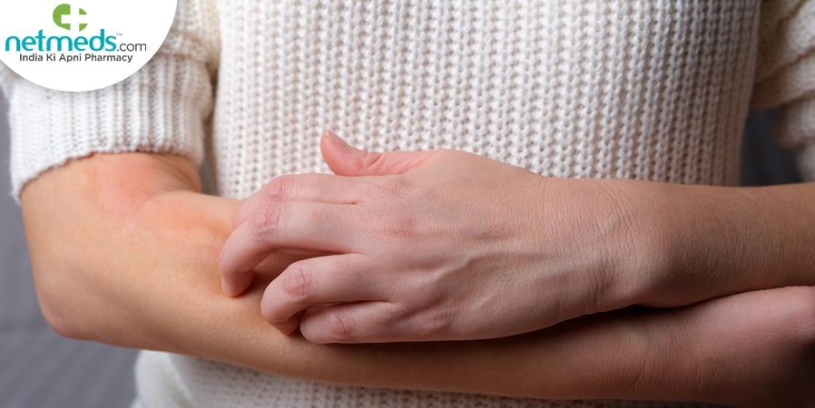 Itching due to neurodermatitis