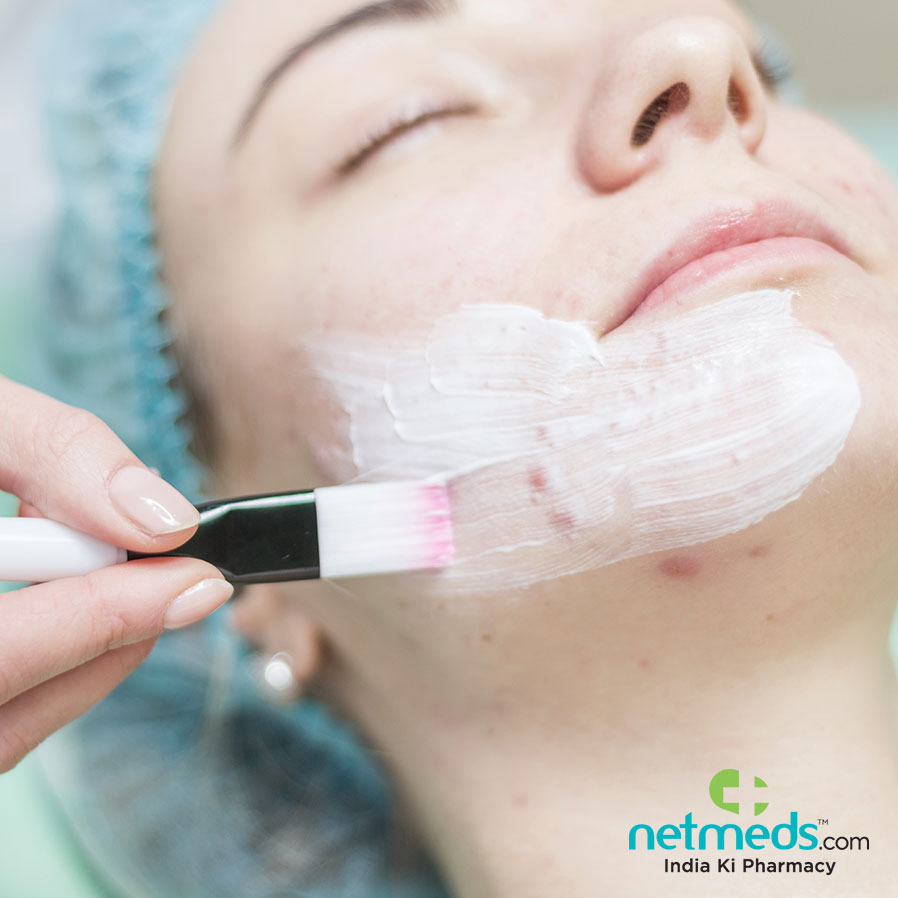 Side Effects In Acne Treatment