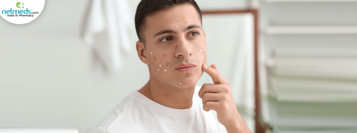 cold urticaria