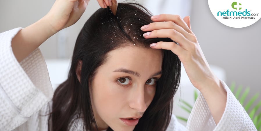 dandruff